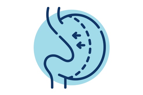 Novas regras para realização de cirurgia bariátrica e metabólica
